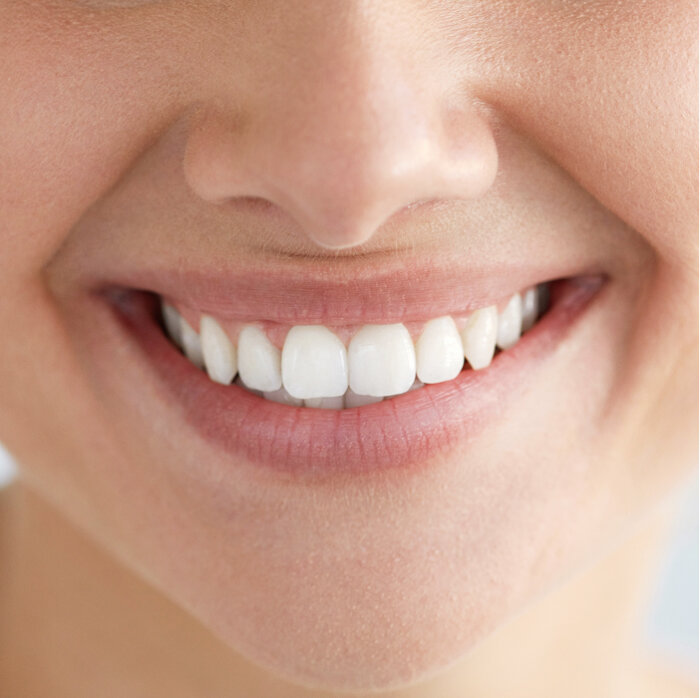 A brighter smile after using the foam