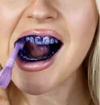 Customer photo of the whitening foam